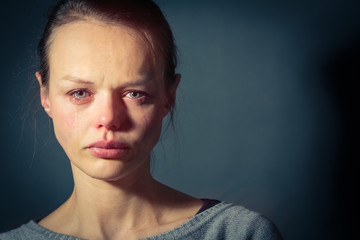 Young woman suffering from severe depression/anxiety/sadness