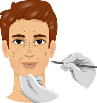 man face marked surgery scalpel clip art preview