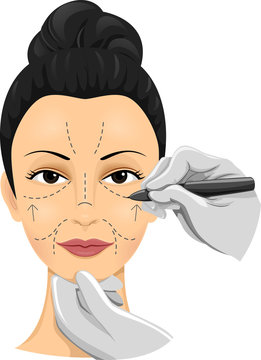 woman face marked cosmetic surgery clip art preview