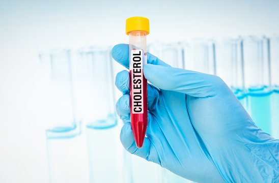 Test-tube with blood sample for CHOLESTEROL test