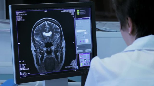 Woman doctor in a hospital explores the tomography brain on the monitor close-up