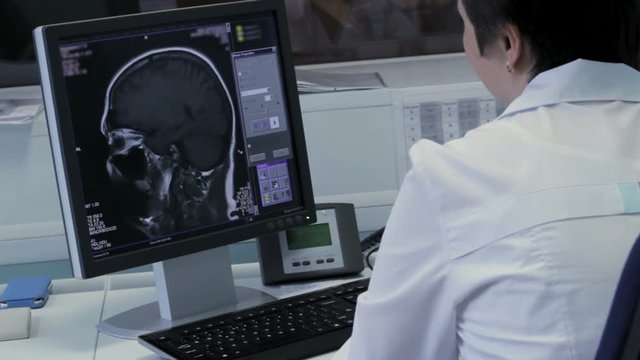 The doctor works at the computer with tomography brain