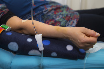Intravenous infusion therapy on mature woman