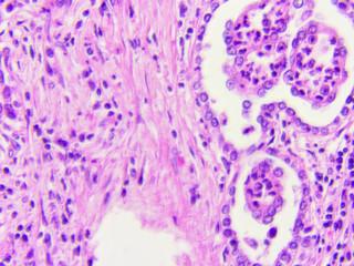 Microscopic image of kidney, zoom x400