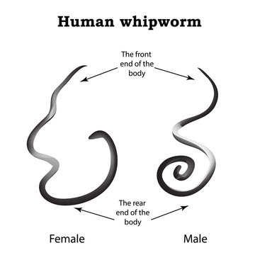 Whipworm. Structure whipworm females. The structure of the male whipworm. Infographics. Vector illustration on isolated background
