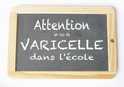 varicelle a l'&eacute;cole ardoise craie 1