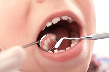 Dentist examining boy's teeth, close up