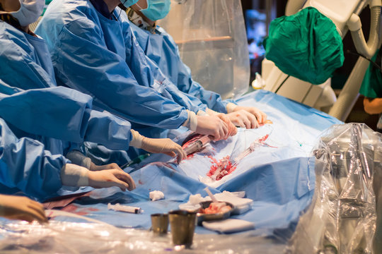 Heart disease operation in Hospital