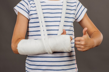  Close-up of a broken arm in a cast on striped shirt  background