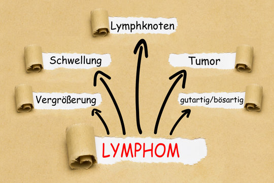 Lymphom Konzept