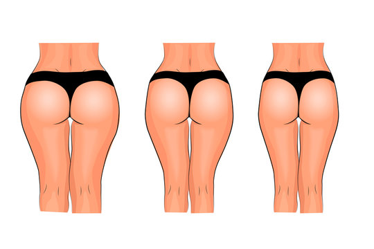 buttocks of women. weight loss. fitness. comparison