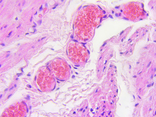 Stomach wall