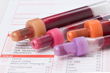 Blutuntersuchung, Blutproben auf einem Laborformular