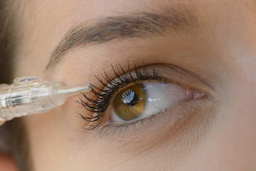 Woman Getting Laser Tattoo Procedure