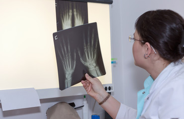 Brunette female doctor examining an x-ray. Selective focus on roentgenogram