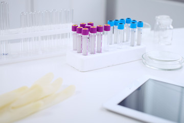 Research laboratory working space. Test tubes and tablet PC are lying at the table. Medical equipment. Blood test