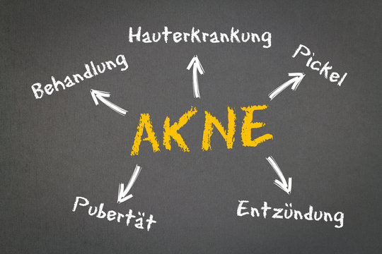 Akne Konzept auf Kreidetafel