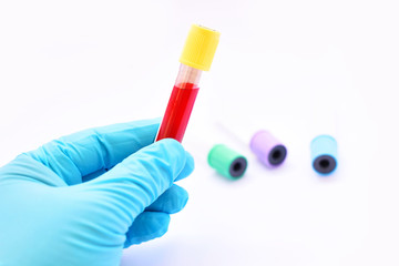 Blood sample for laboratory testing
