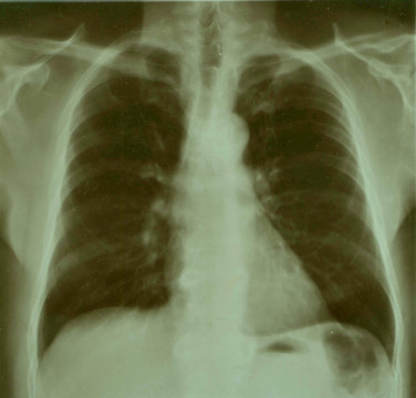 medical rentgen photo