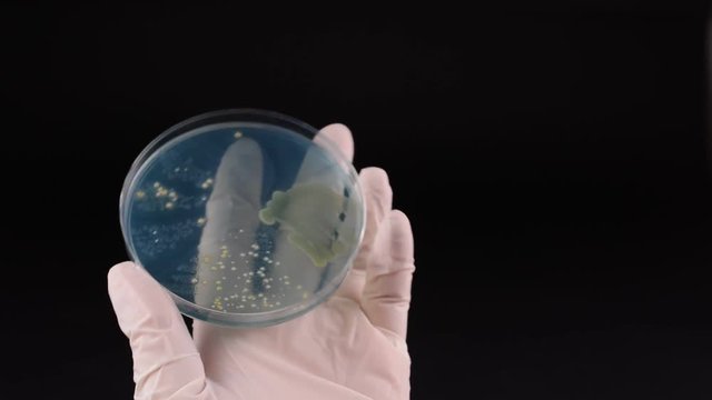 Scientist's hand checking petri dish and pointing with inoculation loop Proteus bacteria