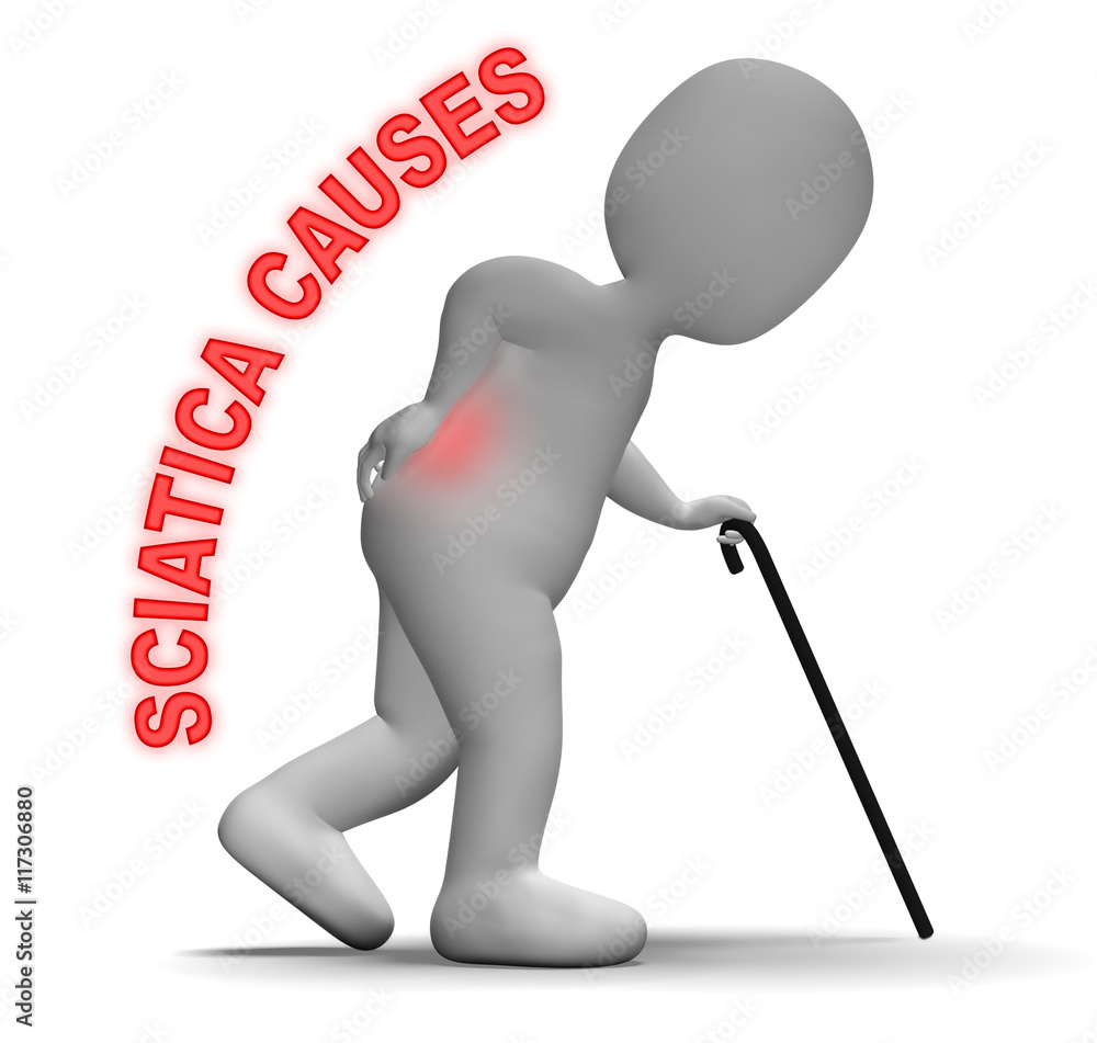 Aufkleber sciatica causes indicates vertebral column and back 3d rendering