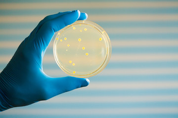 petri dish bacteria growth experiment in hand