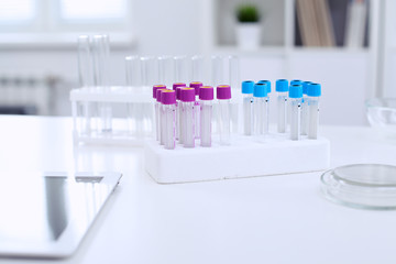 Research laboratory working space. Test tubes and tablet PC are lying at the table. Medical equipment. Blood test