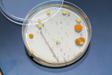 petri dish bacteria growth experiment