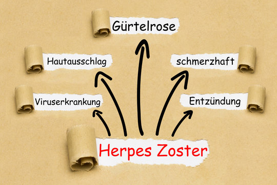 Herpes Zoster