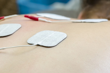 TENS electrodes positioned for back pain treatment in physical t