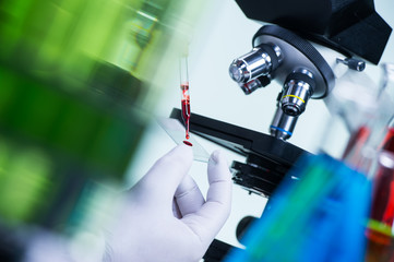 Laboratory scientist holding a slide containing a blood sample w