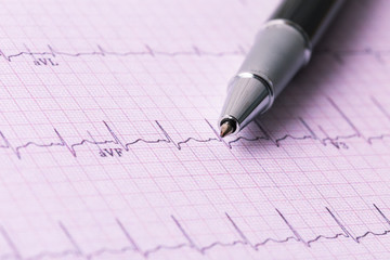 cardiogram and technical pen