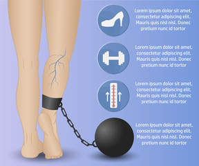 varicose Infographics phlebology