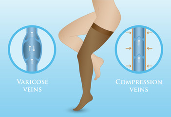 Medical compression hosiery