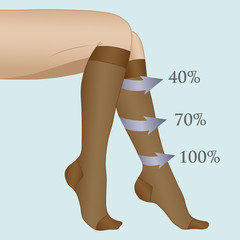 Medical compression hosiery