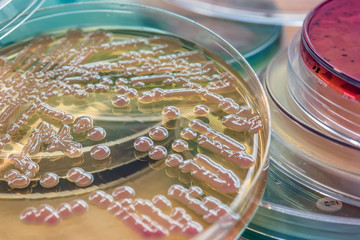 Bacterial colonies culture on MacConkey agar