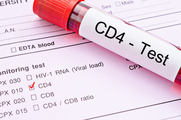 CD4 cell testing.