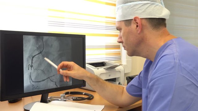 Doctor examining a coronary angiography on the monitor
