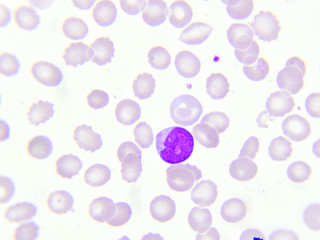 White blood cell in peripheral blood smear, Wright stain
