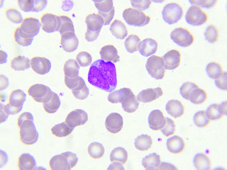 White blood cell in blood smear

