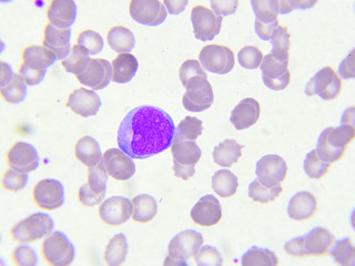 White blood cell in blood smear
