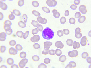 White blood cell in blood smear
