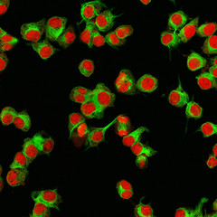 Real fluorescence microscopic view of human neuroblastoma cells