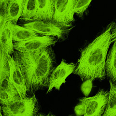 Confocal microscopy of fibroblast cells