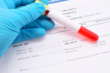 Rubella antibody result