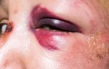 Domestic violence - monocle