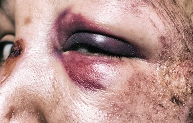 Domestic violence - monocle
