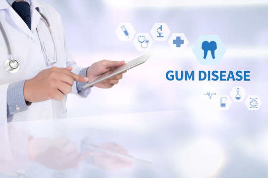 GUM DISEASE  Medical concept Doctor