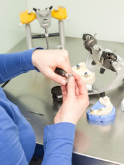 Bearbeitung eines Zahnersatzes im Dentallabor