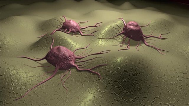 Visualization of several cancer cells on a cellular surface.